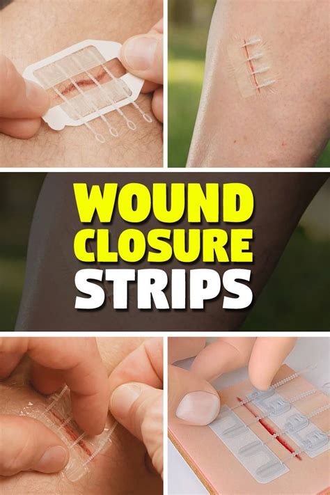 how-long-for-deep-cut-to-heal-without-stitches deep cut healing without stitches