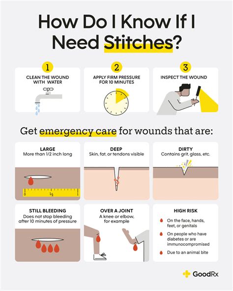 how-long-for-deep-cut-to-stop-bleeding-without-stitches deep cut stop bleeding no stitches