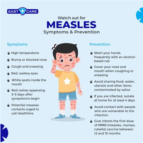 measles symptoms and prevention