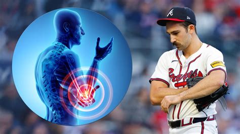 MLB pitcher elbow injury rehabilitation