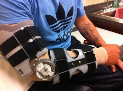 how-long-to-recover-from-injury-like-dustin-may Tommy John surgery rehabilitation